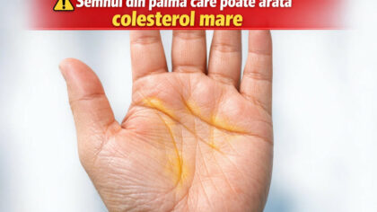 Semnul din palma care poate...